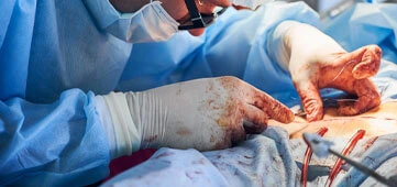 General & Laparoscopic Surgery